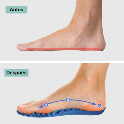 Plantillas ComfyFeet™ Gel Silicona